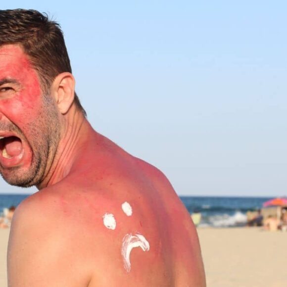 Empoisonnement au soleil : tout savoir sur ce phénomène méconnu de l’été