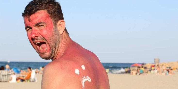 Empoisonnement au soleil : tout savoir sur ce phénomène méconnu de l’été